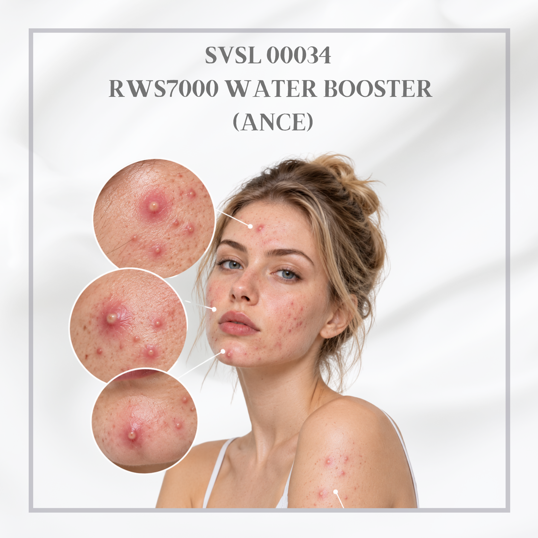 RWS7000 WATER BOOSTER – ACNE & TROUBLED SKIN | Deep Hydration | Acne-Prone Skin Care | Soothes Troubled Skin | Balances Skin Condition